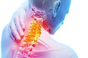 Příznaky krční osteochondózy a pravidel výživy pro nemoc nemoci