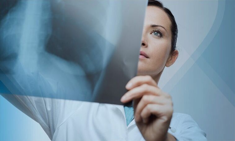lékař zkoumá snímek krční páteře s osteochondrózou